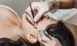 Electrolysis