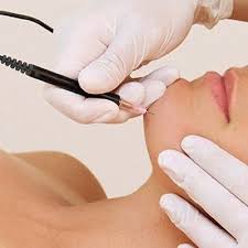 Electrolysis